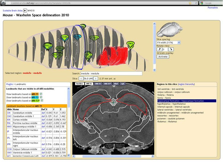 16 landmarks of the mouse brain have been validated as fiducials for registration to WHS