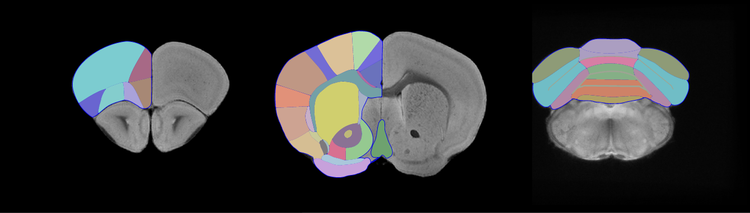 A segmentation guide and probabilistic atlas of the C57BL/6J mouse brain from magnetic resonance imaging A segmentation guide and probabilistic atlas of the C57BL/6J mouse brain from magnetic resonance imaging