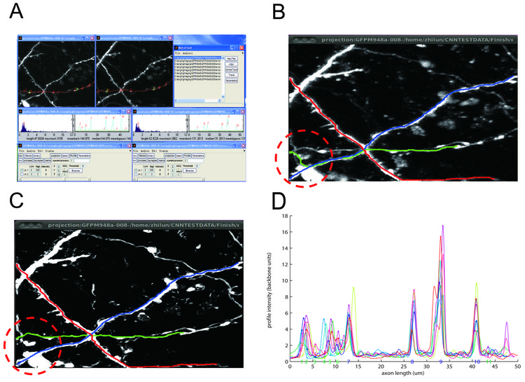 A Semi-automated Program for Axonal Reconstructions from Time-lapse 2-Photon Images
