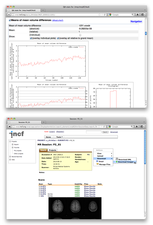 A Simple Tool for Neuroimaging Data Sharing