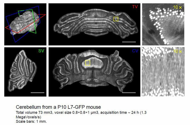Projectome: Set up and testing of a High Performance Computational Infrastructure for processing and visualizing neuro-anatomical information obtained using confocal ultra-microscopy techniques Projectome: Set up and testing of a High Performance Computational Infrastructure for processing and visualizing neuro-anatomical information obtained using confocal ultra-microscopy techniques