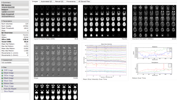 Automated Functional MRI Quality Assessment
