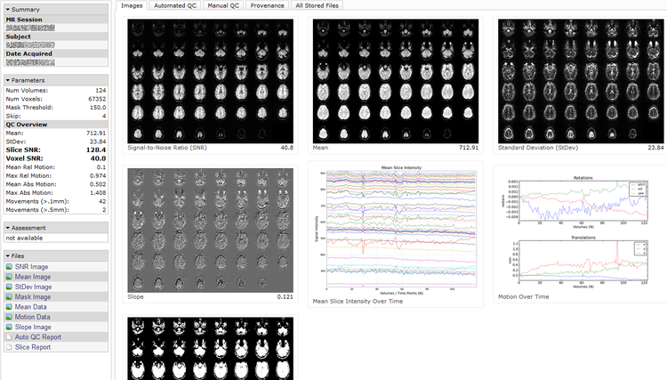 Automated Functional MRI Quality Assessment Automated Functional MRI Quality Assessment