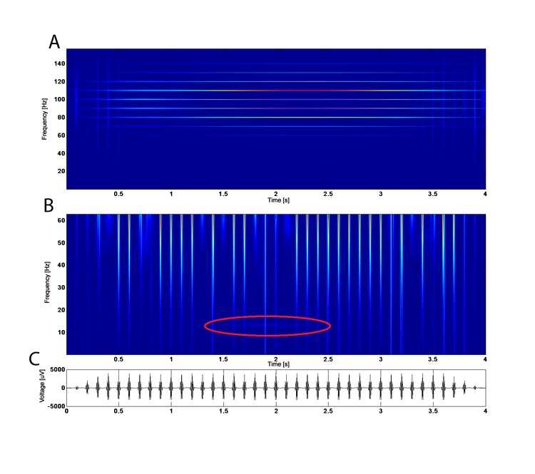 Matching Pursuit Algorithm based on L1 norm Matching Pursuit Algorithm based on L1 norm