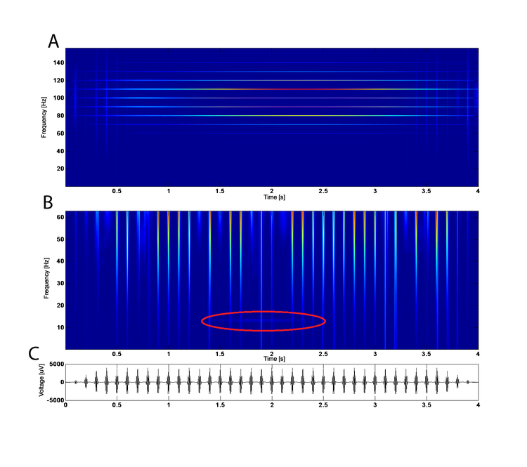 Matching Pursuit Algorithm based on L1 norm