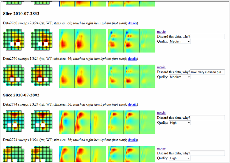 Electrophysiology lab automation: a case study