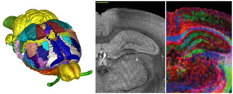 First generation Waxholm atlas of the Sprague-Dawley rat brain