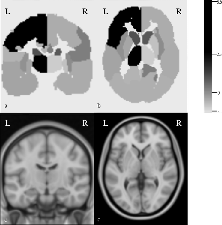 Functional Contributions Derived from the Game-theoretical Analysis of Brain Damage after Stroke