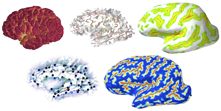 Mindboggle 2: Automated human brain MRI feature extraction, identification, shape analysis, and labeling