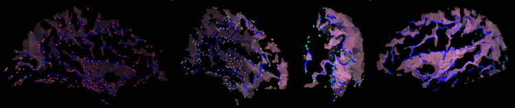 Mindboggle 2 interface: online visualization of extracted brain features with XTK