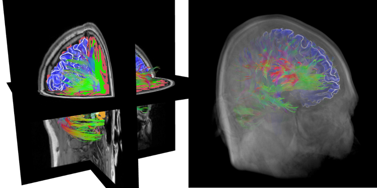 Neuroimaging in the Browser using the X Toolkit